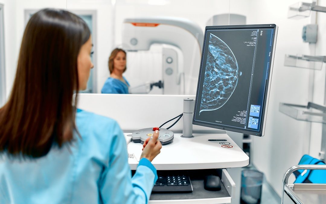 Tumore alla mammella, in Lombardia nuove linee guida per cure ai pazienti – www.lombardianotizie.online