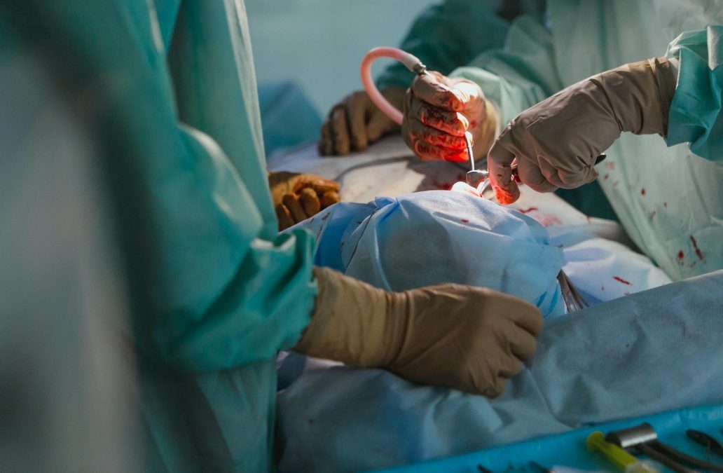 Rimossa massa tumorale di 42 kg, intervento record al Policlinico di Milano – www.lombardianotizie.online