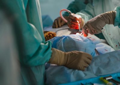 Rimossa massa tumorale di 42 kg, intervento record al Policlinico di Milano – www.lombardianotizie.online