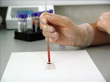 400 mila euro per uno studio sull’epilessia: la Regione Marche stipula una convenzione con l’Azienda Ospedaliero Universitaria p… – www.regione.marche.it