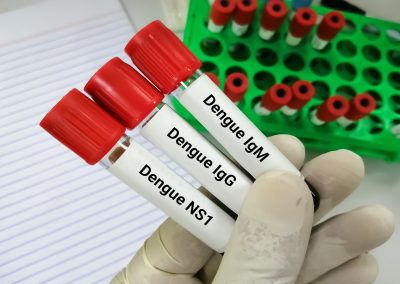 Virus Dengue, identificato in provincia di Lodi primo caso lombardo – www.lombardianotizie.online