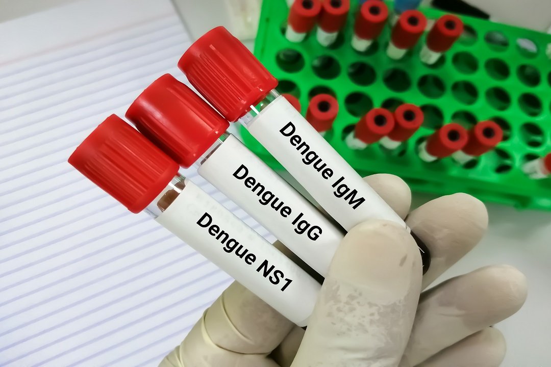 Dengue-provette-test-1.jpg