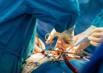 In Lombardia il primo trapianto di cuore da donatore a cuore fermo – www.lombardianotizie.online