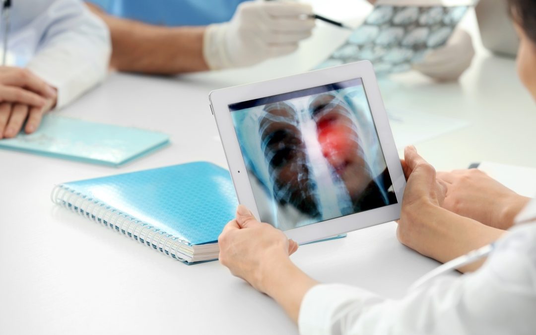 Regione Lombardia avvia programmi screening tumore prostata e polmoni – www.lombardianotizie.online