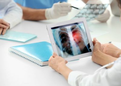 Regione Lombardia avvia programmi screening tumore prostata e polmoni – www.lombardianotizie.online