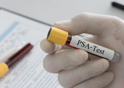Screening gratuito in Lombardia per prevenire il tumore alla prostata – www.lombardianotizie.online