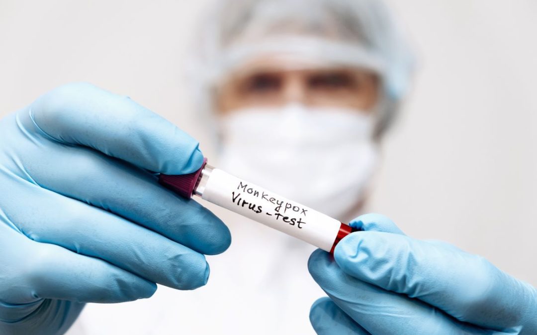 in Lombardia nessun caso con variante di tipo I – www.lombardianotizie.online