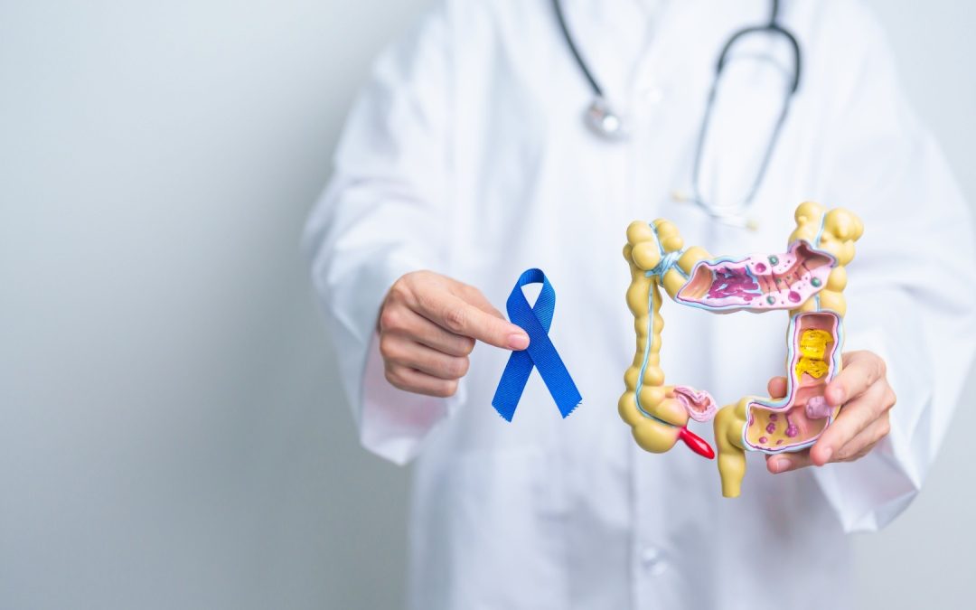 Colon retto, in Lombardia studio pilota per incentivare lo screening – www.lombardianotizie.online