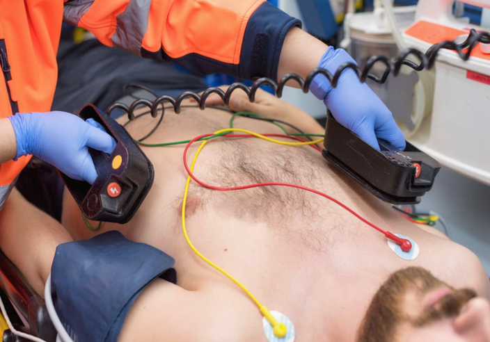 Defibrillatori, 59 mila euro all’Ospedale di Perugia per gestione e formazione. Previsti nuovi dispositivi sul territorio – www.regione.umbria.it