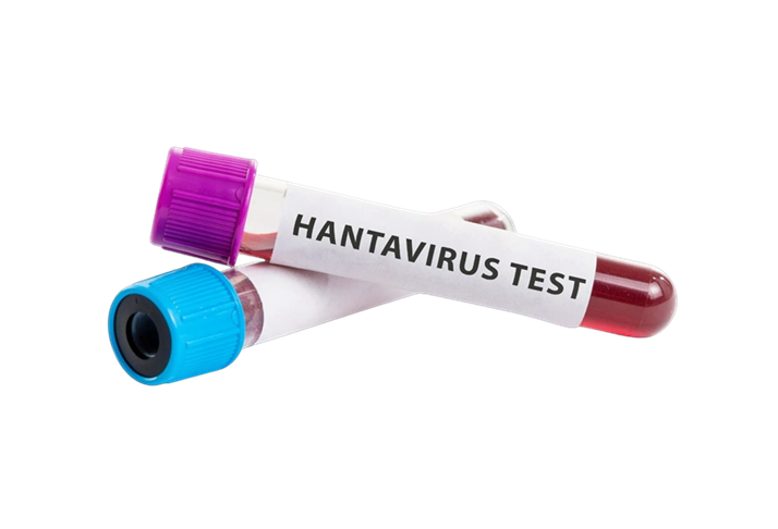 Hantavirus, nessun allarme in Umbria, la Regione attiva i Protocolli di massima cautela – www.regione.umbria.it