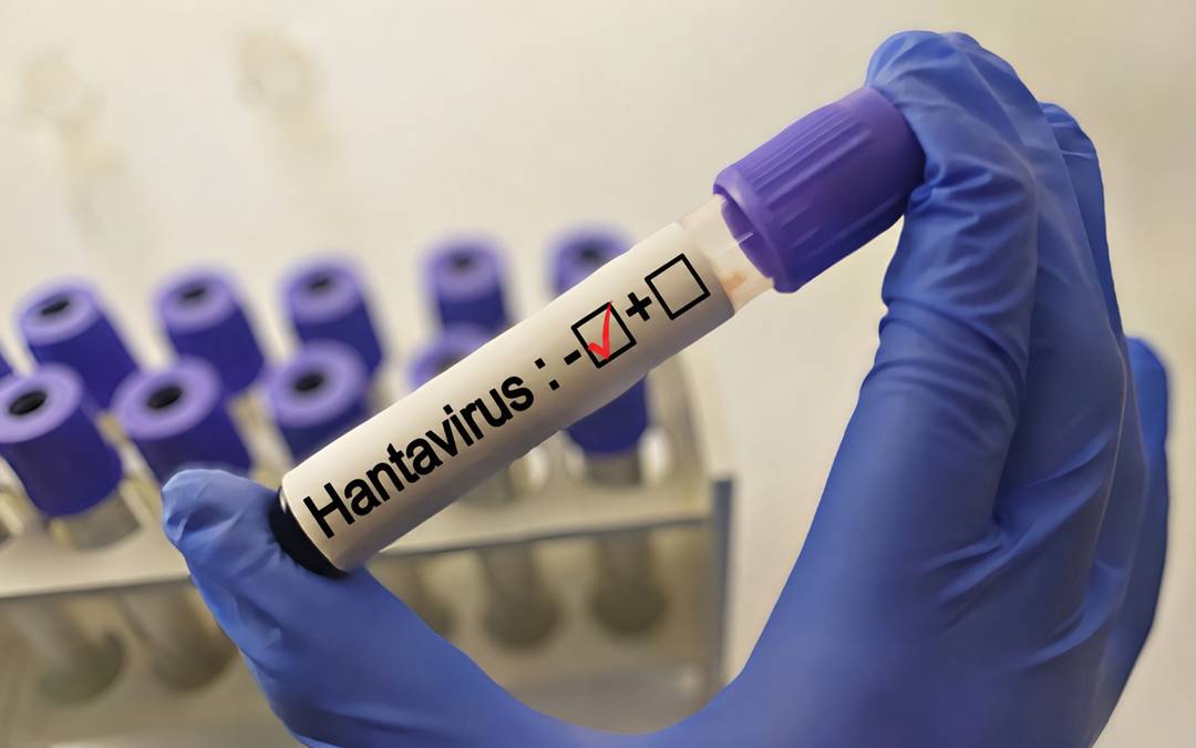 Hantavirus, donna negativa in quarantena al Sacco di Milano – www.lombardianotizie.online