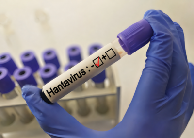 Hantavirus, donna negativa in quarantena al Sacco di Milano – www.lombardianotizie.online