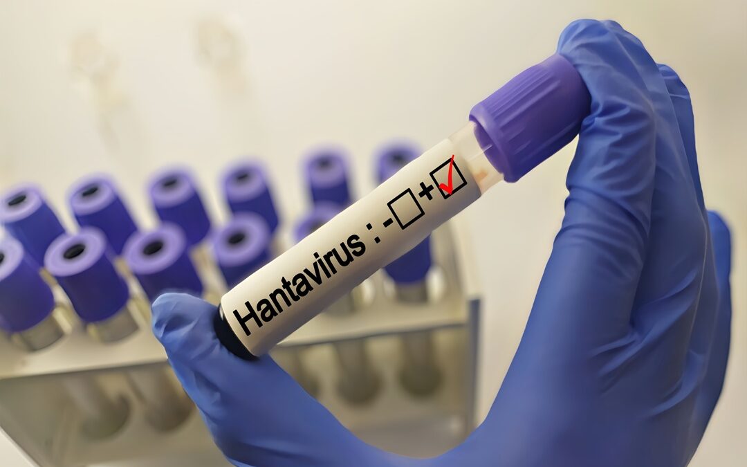 Hantavirus, negativo il turista inglese in quarantena al Sacco – www.lombardianotizie.online