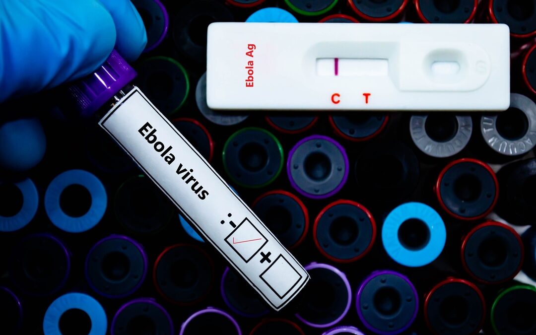 Ebola, negativi i due pazienti al Sacco di Milano – www.lombardianotizie.online